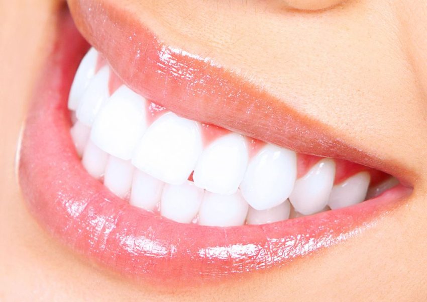 Straightening Your Smile: The Advantages of Invisalign in Sheffield